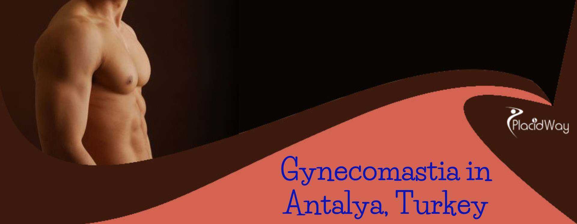 Gynecomastia in Antalya, Turkey